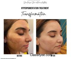 Pigmentation and Melasma Specialist